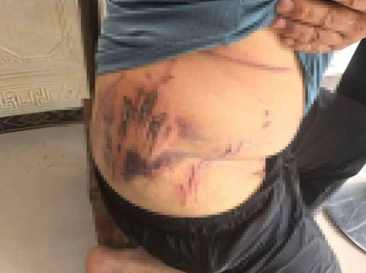 白俄罗斯 vs丹麦
_湖北鹤峰县疑再现老虎踪迹白俄罗斯 vs丹麦
,村民家猪遭袭,玉米地发现脚印,此前男子自称干农活时被抓伤,当地回应